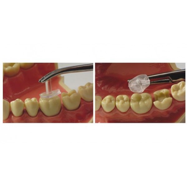 Matriz Oclusal Transp Kit Intro 32u*